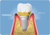 fig02_07.png