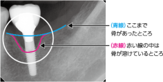fig02_08.png